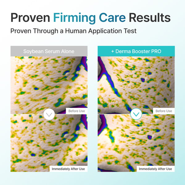 [🔐Unlock $99] mixsoon Derma Booster PRO