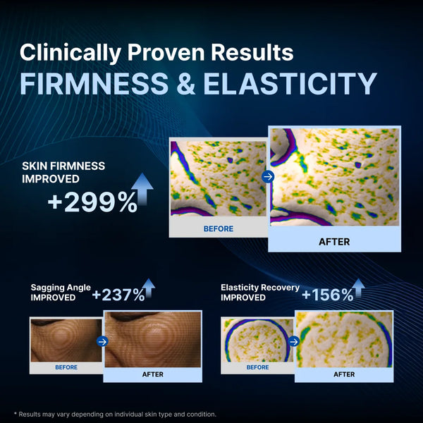 [🔐Unlock $99] mixsoon Derma Booster PRO